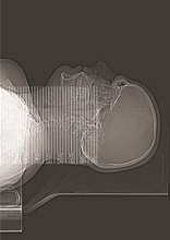 KSW 26 Karol Bedorf kontuzja  KSW 26 Karol Bedorf kontuzja