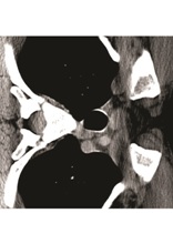 KSW 26 Karol Bedorf kontuzja  KSW 26 Karol Bedorf kontuzja