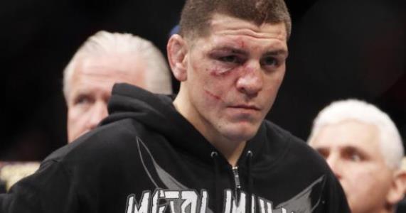 Nick Diaz