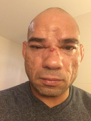 Evangelista Cyborg Santos